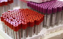 獨(dú)立醫(yī)學(xué)實(shí)驗(yàn)室：從216家增至356家，未來(lái)五年市場(chǎng)再添200億..